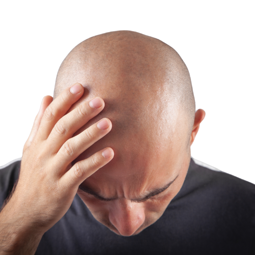 Hair Transplant in Turkey - FUE & DHI at Q Care