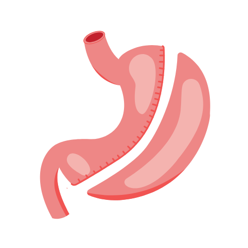 Gastric Sleeve and Bypass - Q Care